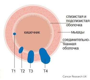 риск